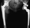 рентгеновский снимок после операции